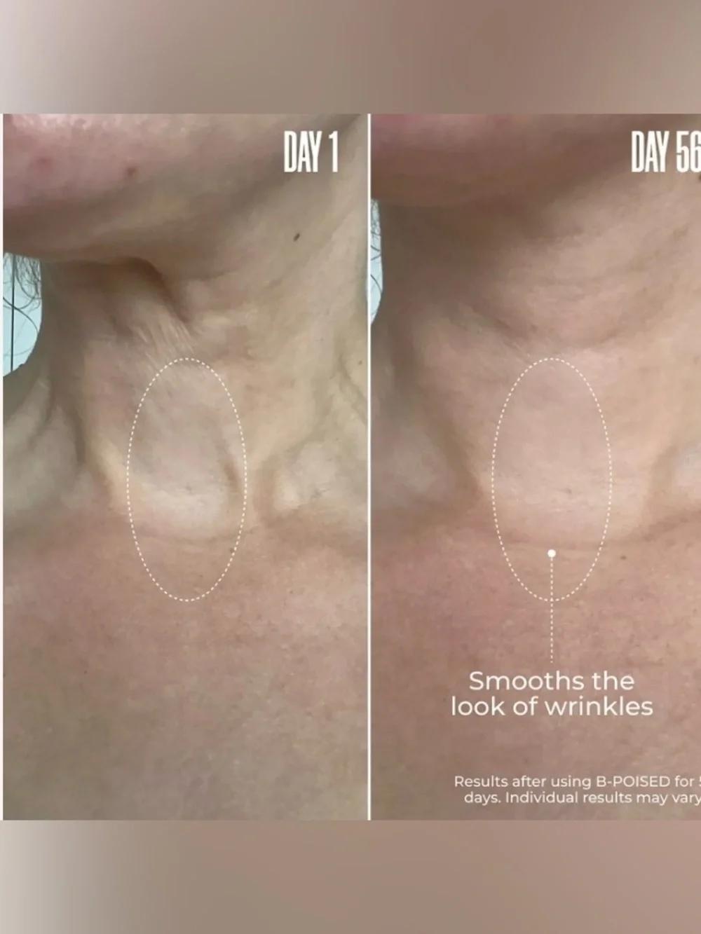 Maelys B-POISED Neck & Décolleté Firming Cream